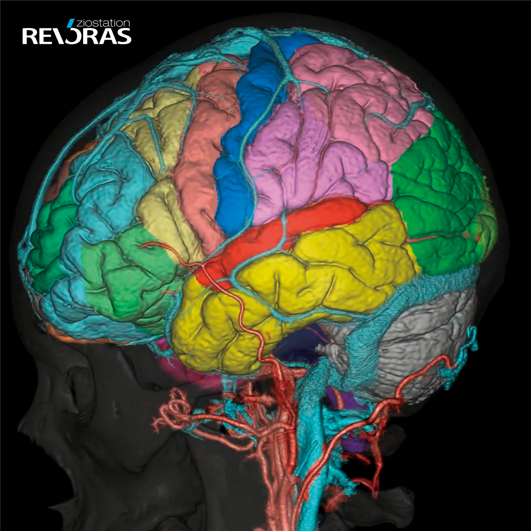 Brain WEB – Ziosoft